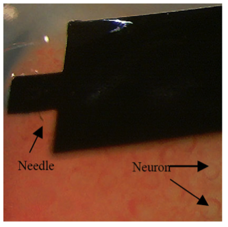 Intracellular Neuronal Recording with Flexible Micro-machining Probe Implants